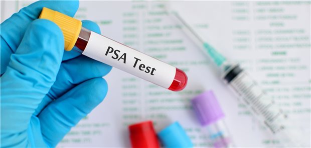 Risikoadaptierte Früherkennung auf Basis des PSA-Tests. 