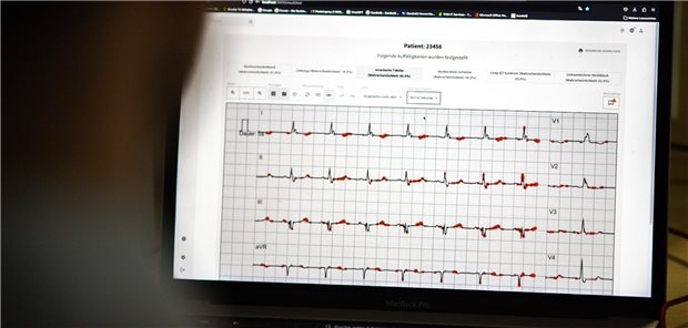 Künstliche Intelligenz unterstützt Herzdiagnostik „Riska“ kann EKG-Aufnahmen aus unterschiedlichen Quellen einlesen und auswerten. Dabei erkennt das System auch komplexe Muster, wie sie bei Veränderungen im Herzmuskel auftreten.