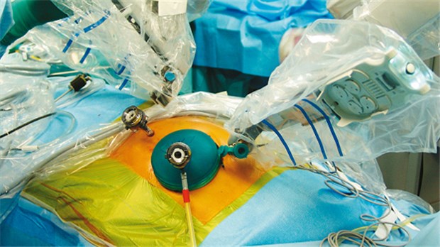 Kliniken wehren sich gegen Nutzen-Prüfung Roboter verpflanzt Bauchspeicheldrüse: Die DKG will, dass solche Innovationen schnell ins System kommen.