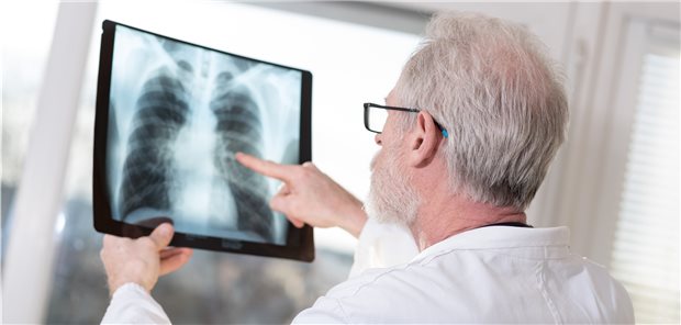 Röntgen-Thorax: RSV ist im Alter eine häufige Ursache für Pneumonien.