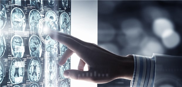 Ärzte verdienen mit Kontrastmitteln teils erheblich dazu Röntgenärzte unter Beschuss: Durch die pauschale Abrechnung von Kontrastmitteln mit den Krankenkassen können sie teils erheblich dazuverdienen.