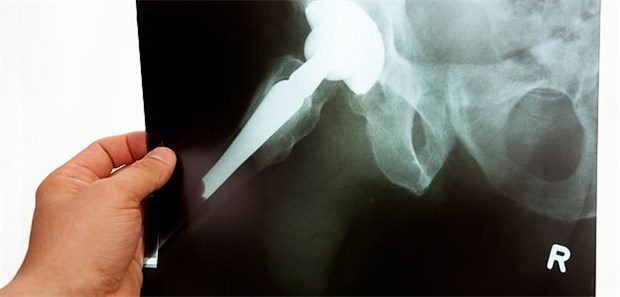 Fachärzte ziehen die Notbremse Röntgenleistungen lassen sich nicht mehr kostendeckend durchführen - darum röntgen Fachärzte in Nordrhein nun nur noch in dringenden Fällen.