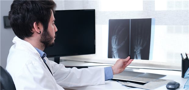 Röntgenuntersuchung der Hände vor Therapiebeginn mit einem Biologikum: So erhält man einen Ausgangsbefund im Hinblick auf eine Rheumatoide Arthritis und kann auch gegebenenfalls den Verlauf einer gleichzeitig bestehenden DIP-Arthrose im Auge behalten. (Symbolbild mit Fotomodell)