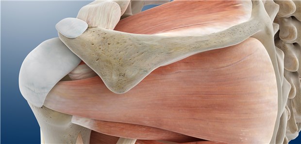 Rotatorenmanschette: Patienten mit Supraspinatussehnenriss, die nach der Op nicht immobilisiert waren, hatten weniger Schmerzen.