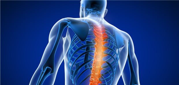 Rückenschmerzen sind in der Bevölkerung weit verbreitet. Die Diagnostik bei Betroffenen ist nicht immer einfach.