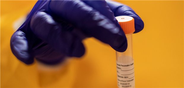 Labore melden steigende Positivrate bei Corona-Tests Rund 1,2 Millionen SARS-CoV-2-PCR-Tests haben die ALM-Labore in der vorigen Woche durchgeführt.