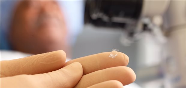 Rund 800.000 Katarakt-Operationen werden pro Jahr in Deutschland durchgeführt.