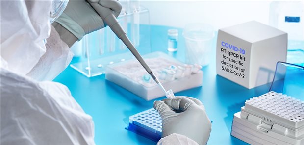 Labore: Delta-Variante schon bei zehn Prozent COVID-19-PCR-Tests in der Laboranalyse: Derzeit nimmt die Anzahl der wöchentlich vorgenommenen Tests deutlich ab.