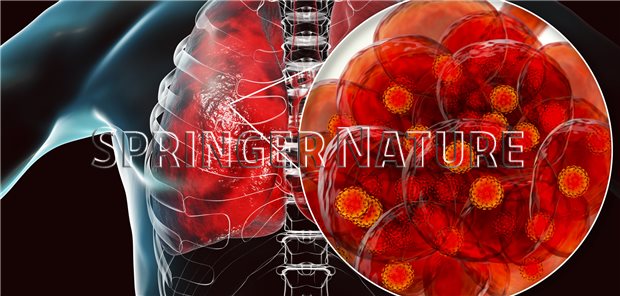 Ist Asthma ein Risikofaktor für CoronaInfektion?