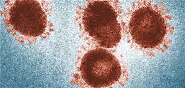 Keine SARS-CoV-2-Reinfektion bei Affen SARS-CoV-2 in einer EM-Aufnahme: Im Schnitt überträgt ein Infizierter das Virus auf zwei bis drei weitere Personen.