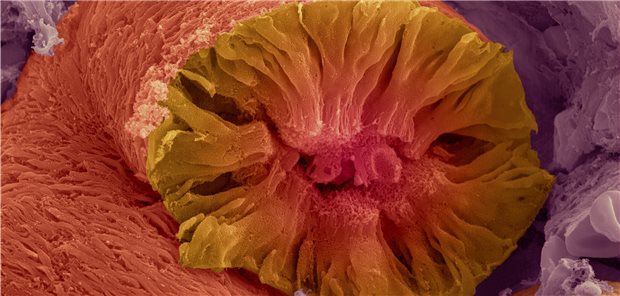 SARS-CoV-2 infiziert im Nierengewebe vor allem die Zellen der Tubuli und Glomeruli, wie Ärzte bei Obduktion von COVID-19-Patienten entdeckt haben (Symbolbild).