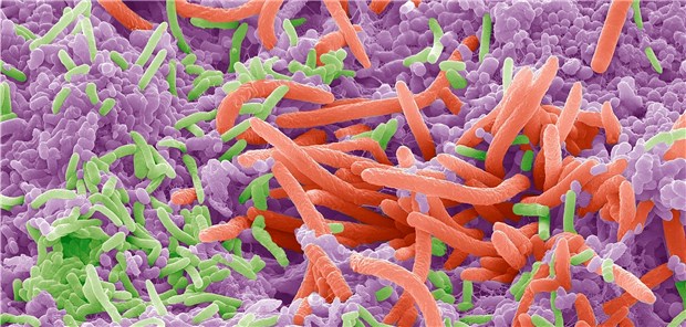 SEM-Aufnahme von Bakterien auf der Oberfläche einer menschlichen Zunge.