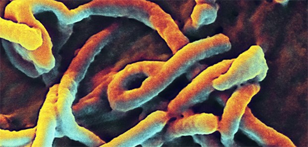 Briten und Amerikaner starten Vakzin-Tests SEM von Ebolaviren: Jetzt sollen Vakzinen gegen die Filoviren am Menschen getestet werden.