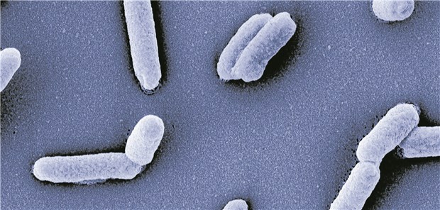 Neue Software hilft bei der Salmonellen-Diagnose Salmonellen-Stämme lösen unterschiedliche Krankheiten aus – die Unterscheidung der Stämme erleichtert eine neue Software.