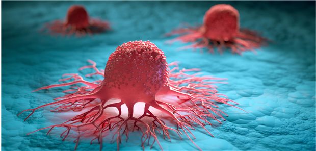 Schematische Darstellung von entarteten Zellen.