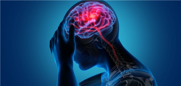 Schlaganfall: Die Interpretation einer Studie zu NOAK bei niedrigem Schlaganfallrisiko ist schwierig.