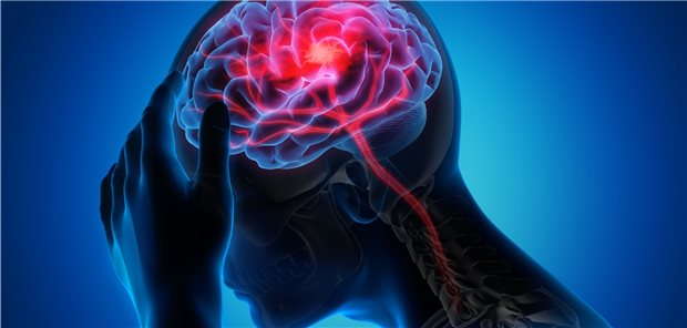 Schlaganfall nach TIA