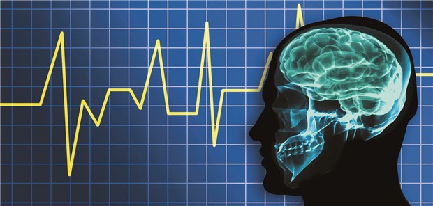 Schlaganfallprädiktion: Wie lassen sich Risikopatienten zuverlässiger identifizieren?