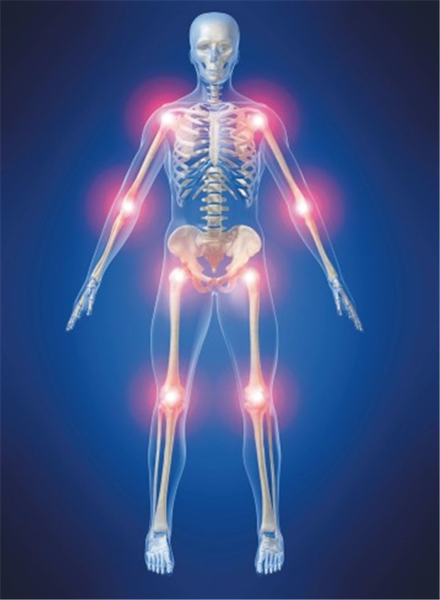Rheuma plus Fibromyalgie - Komorbidität gibt Rätsel auf Schmerzen an Gelenken und auch Muskeln sind nur eines der Symptome eines Fibromyalgie-Syndroms. © sebastian kaulitzki / fotolia.com