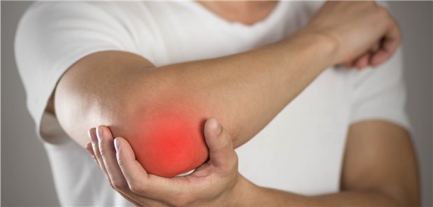 Schmerzen im Ellenbogen: Ist es ein Tennisarm?