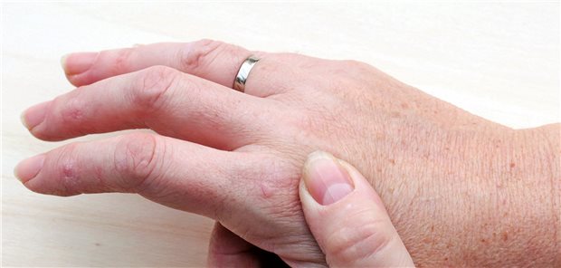 Schmerzen im Fingergelenk: Für Patienten mit Psoriasis-Arthritis ist das Behandlungsspektrum jetzt breiter geworden.