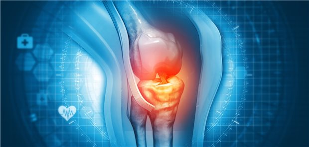 Schmerzen im Knie: Über starke Schmerzen in den unteren Extremitäten klagten in einer Studie Patienten, die mit Methotrexat behandelt worden waren.