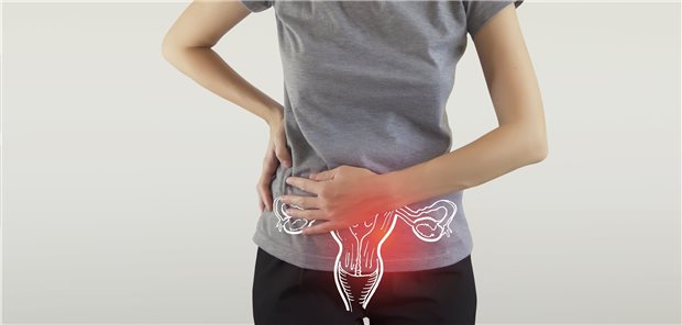 Schmerzen im Unterbauch, manchmal aber nur Kreuzschmerzen: Ovarialtorsionen haben ein breites Spektrum möglicher Symptome.