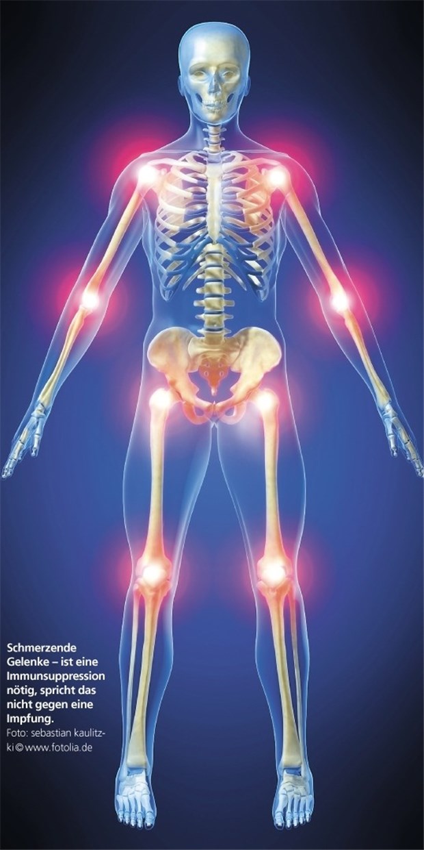 Schmerzende Gelenke - ist eine Immunsuppression nötig, spricht das nicht gegen eine Impfung.