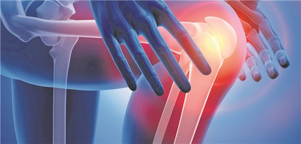 Schmerzursache Knorpelschaden. Je nach Schweregrad der Schädigungen werden vier Stadien unterschieden. Bei Schweregrad 3 und 4 soll nun eine zusätzliche ambulante Therapieoption helfen.