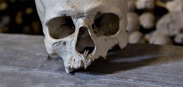 Gab es schon spezialisierte Chirurgen vor 6000 Jahren? Schon in der Bronzezeit konnten Menschen Schädel-Ops durchführen.