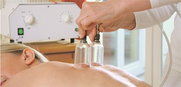 Gröhe soll Tätigkeit von Heilpraktikern einschränken Schröpfen gehört klassischerweise zum naturheilkundlichen Tätigkeitsspektrum.