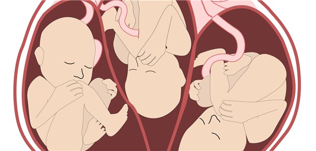 Schwangerschaften mit Eizellspende sind oft mit großen Risiken für Mutter und Kind(er) assoziiert