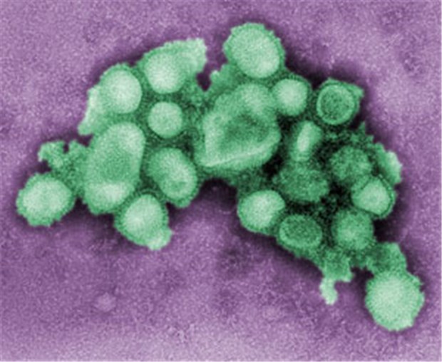 "Das in Mexiko neu entstandene Grippevirus hat durchaus Potenzial für eine Pandemie" Schweinegrippevirus vom Typ A/CA/4/09.
