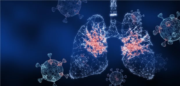 Schwere Pneumonien können auf ein variables Immundefektsyndrom hindeuten.