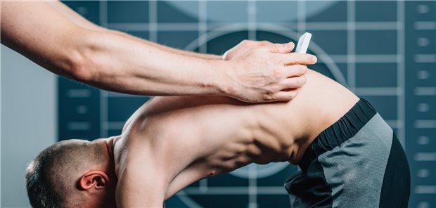 Scoliose-Screening bei einem Jugendlichen. Die idiopathische Skoliose gehört unter bestimmten Voraussetzungen zu den Erkrankungen, die von dem neuen ASV-Angebot umfasst werden.