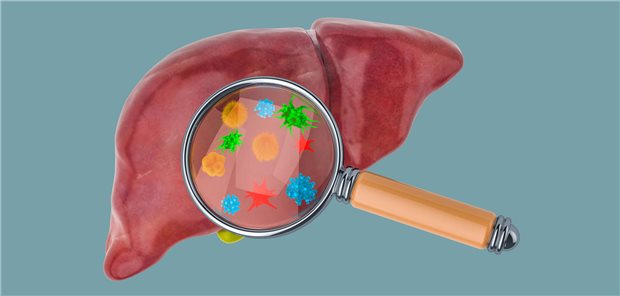 Screening auf Hepatitis B und C: Man könnte – und sollte nach Auffassung der DEGAM – zielgenauer auf Risikogruppen fokussieren.
