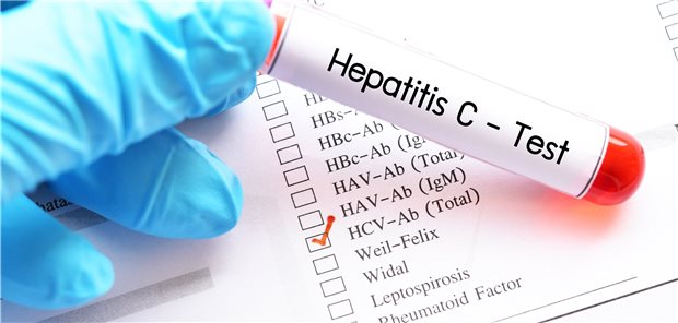 Internisten begrüßen GBA-Beschluss zum Hepatitis-Screening Screening auf Virushepatitis: Künftig ein Angebot der GKV.