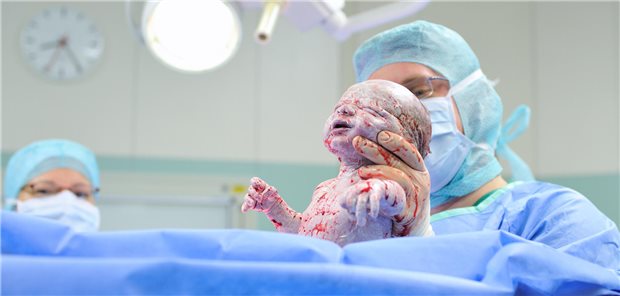 Sectio: Welche Faktoren einen Einfluss auf das Mikrobiom des Neugeborenen haben, haben Wissenschaftler aus den Niederlanden untersucht.