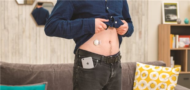 Seit 2016 werden CGM von den Krankenkassen übernommen. Die Barmer stellt das in Frage.
