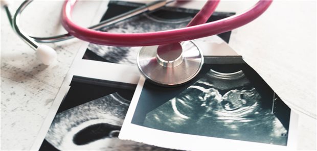 Ultraschallbilder eines Embryos und ein Stethoskop