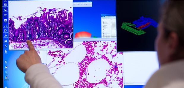 Histologischer Befund. Ist es ein seltener Tumor? Ärzte in onkologischen Spitzenzentren sollten das entscheiden können.