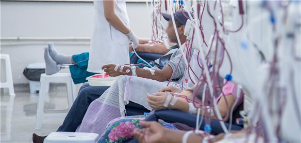 Patienten sitzen in einer Reihe und bekommen eine Blutwäsche