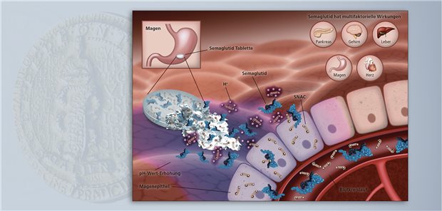 Semaglutid in der Ko-Formulierung mit SNAC wird im Magen aus der Tablette freigesetzt. SNAC verbessert die enterale Absorption des GLP-1-Analogons und schützt es gleichzeitig vor dem proteolytischen Abbau im Magen.