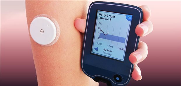 Sensor und Lesegerät des isCGM-Systems: Patienten schätzen die einfach Handbarkeit und die akkuraten Messwerte.