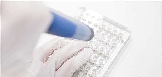 Brandenburg sequenziert weiter nur zehn Prozent der Corona-Proben Sequenzierung von positiven Coronavirusproben. Am Carl-Thiem Klinikum in Cottbus würde man gerne mehr Proben analysieren.