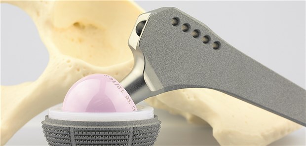 Wo der Hase im Pfeffer liegt Sichere Endoprothese? Mit der novellierten Medizinprodukteverordnung zielt die EU auf Transparenz und Patientensicherheit ab.