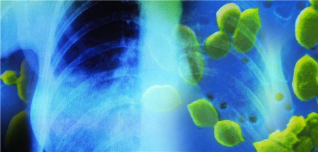 Abwehr gegen invasive Pneumokokken Sie sind die häufigsten Erreger ambulant erworbener Lungenentzündungen: Pneumokokken (grün).