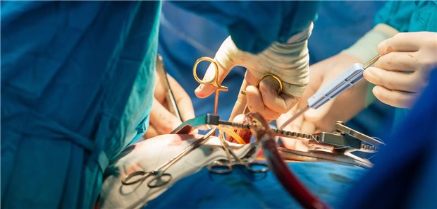 Chirurgenteam bei der Operation am Herzens eines Patienten im Operationssaal.