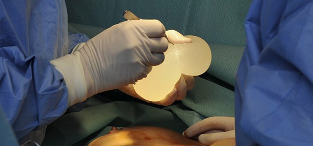 Billig-Silikon in weiteren Implantaten entdeckt Silikon-Implantat nach der Entnahme: Das BfArM erweitert seine Warnung.