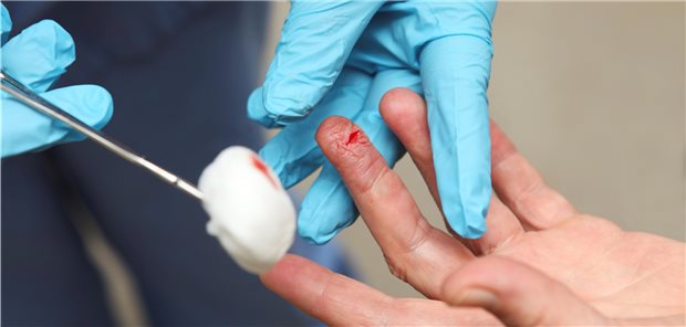Wundversorgung am Finger